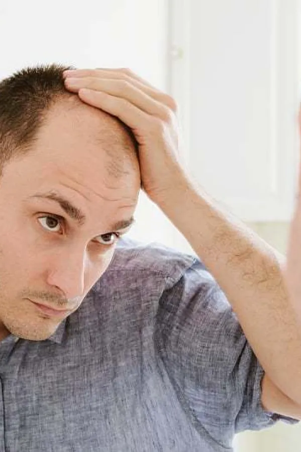 Opada vam kosa? Isprobajte test koji otkriva u čemu je tačno problem