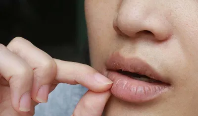 Suva usta mogla bi biti simptom stanja koje zahtijeva hitnu pomoć