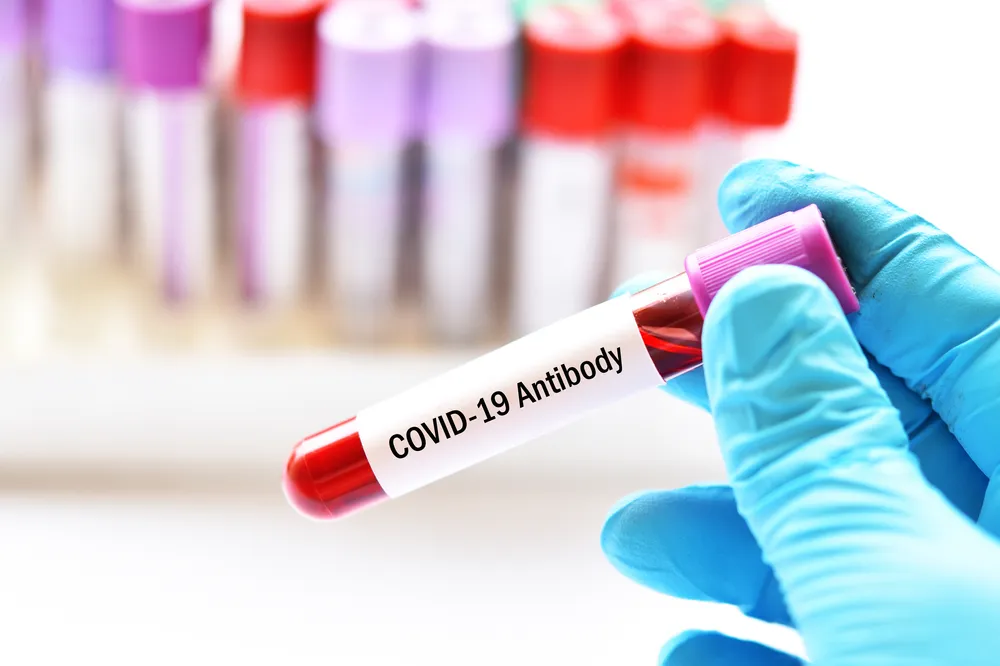 Progla&scaron;en prestanak epidemije kovida 19 na teritoriji Srbije