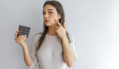 Bubuljice od čokolade: Da li je ovo istina ili samo jo&scaron; jedan mit?