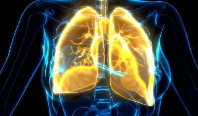 Naučnici otkrili iznenađujuću vezu između &scaron;ećera i raka pluća