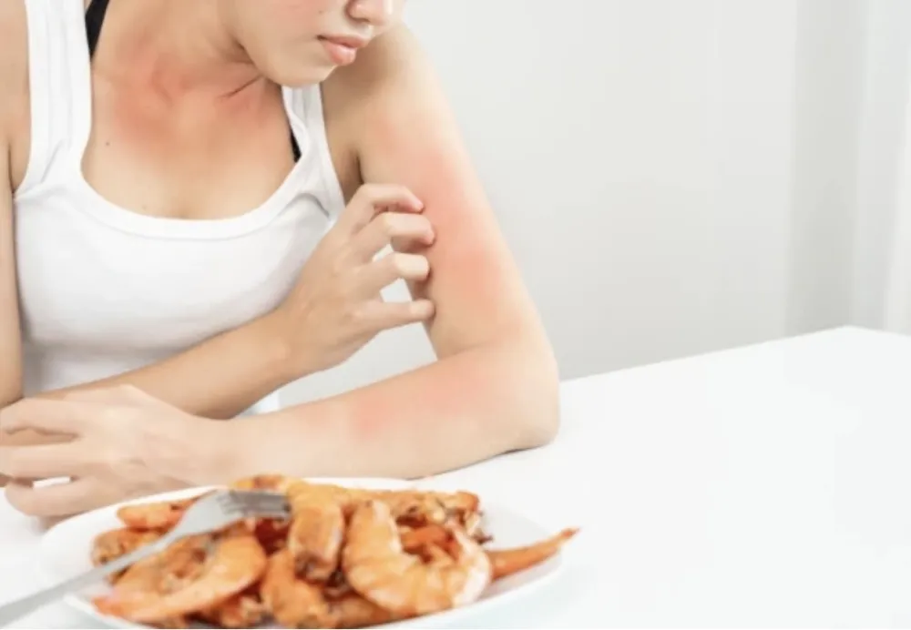 Novo otkriće: Crijevne imunolo&scaron;ke ćelije sprečavaju alergije na hranu&nbsp;