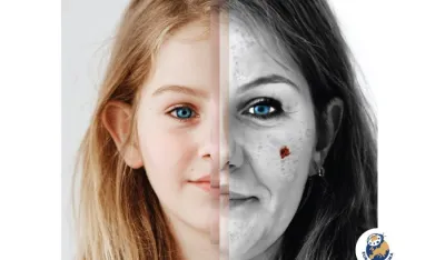 Euromelanoma dan organizuje 12 op&scaron;tina, ljekari pozivaju na preventivne preglede