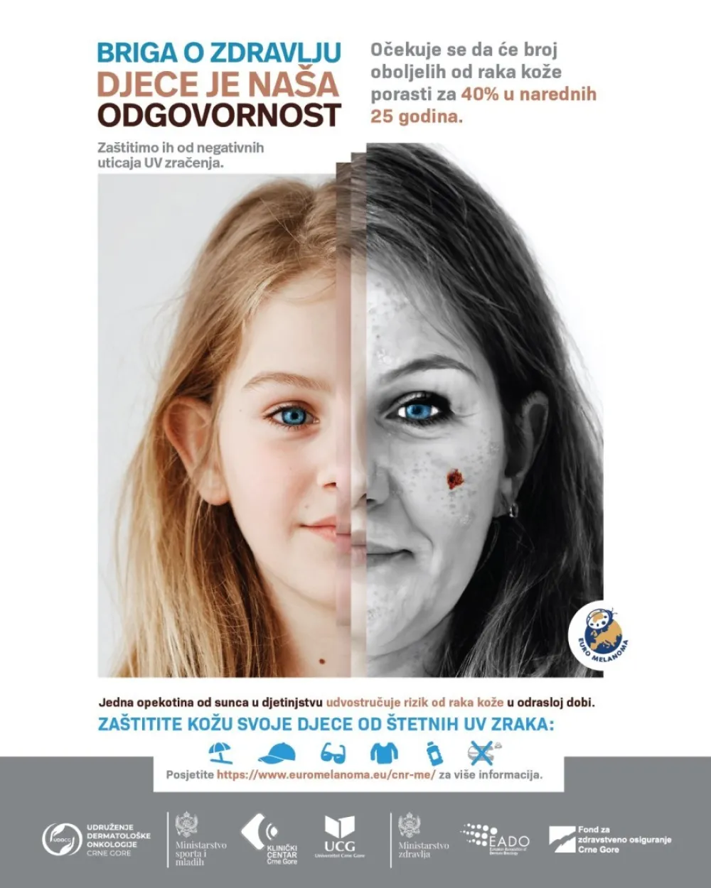 Euromelanoma dan organizuje 12 op&scaron;tina, ljekari pozivaju na preventivne preglede