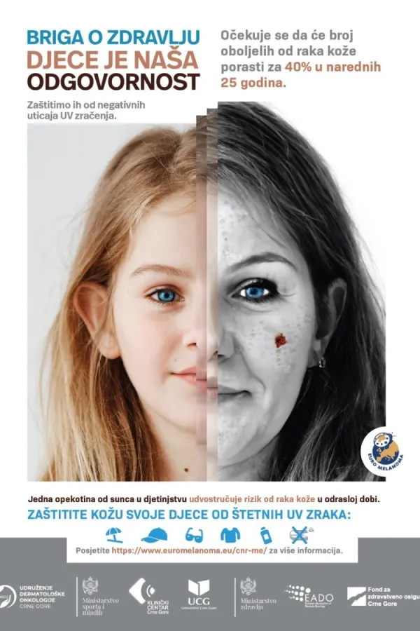 Euromelanoma dan organizuje 12 op&scaron;tina, ljekari pozivaju na preventivne preglede