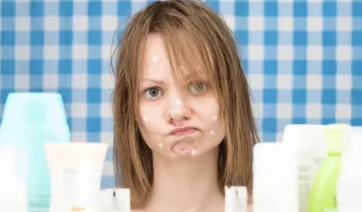 Da li pasta za zube re&scaron;ava problem sa aknama?