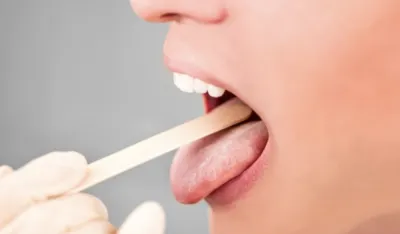 Izgled i promene na jeziku mogu ukazivati na ozbiljna zdravstvena stanja