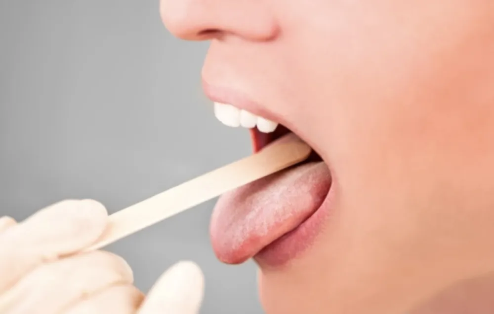 Izgled i promene na jeziku mogu ukazivati na ozbiljna zdravstvena stanja