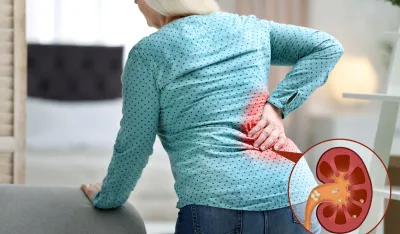 Ovi zanemareni simptomi mogu ukazivati na rak bubrega