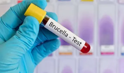 Bruceloza u Vogo&scaron;ću