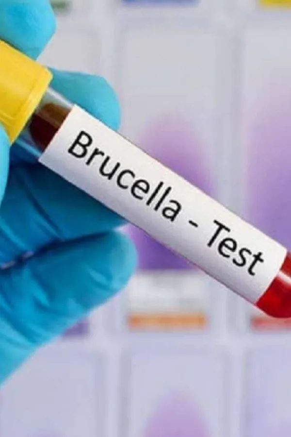 Bruceloza u Vogo&scaron;ću