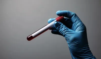 U Velikoj Britaniji odobren inovativni lijek za rak krvi