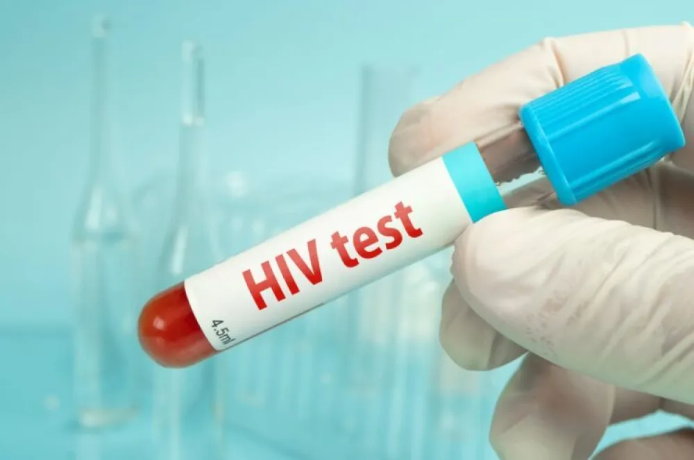 SAD odobrile vakcinu protiv HIV-a: Prima se dva puta godi&scaron;nje