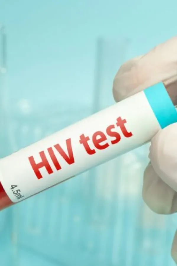 SAD odobrile vakcinu protiv HIV-a: Prima se dva puta godi&scaron;nje