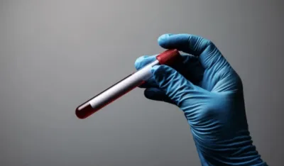 Otkrivena nova krvna grupa