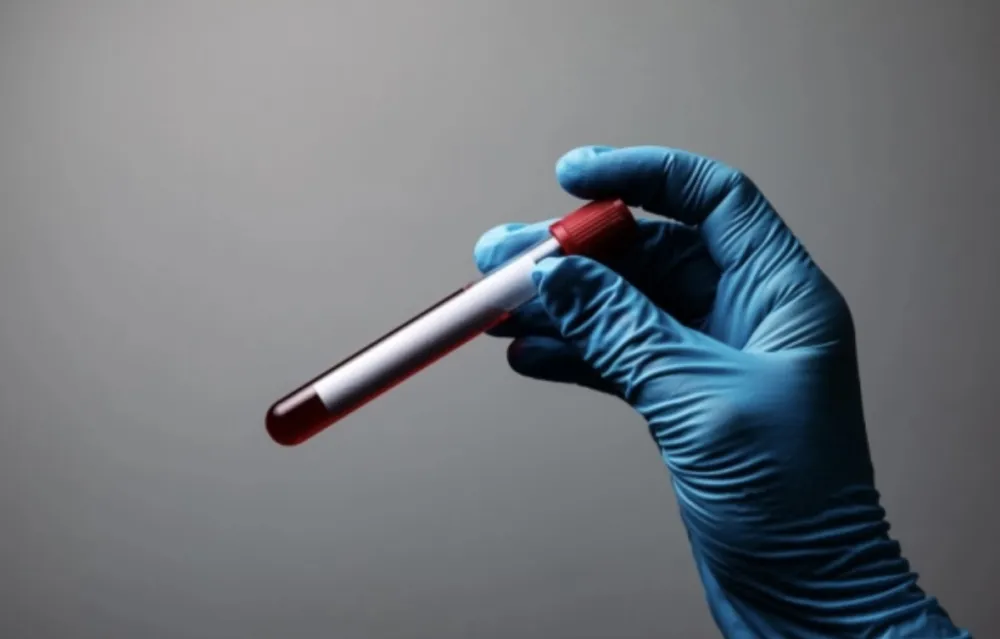 Otkrivena nova krvna grupa