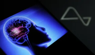 Kina uspje&scaron;no testirala prvi implantat u mozgu čovjeka