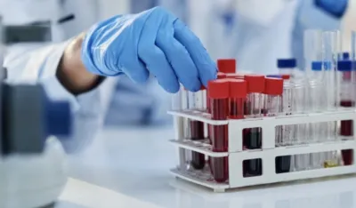 Novi tretman liječi težak oblik dijabetesa tip 1