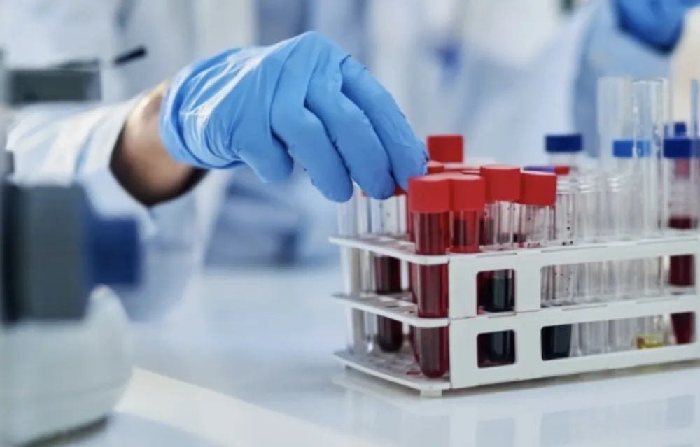 Novi tretman liječi težak oblik dijabetesa tip 1