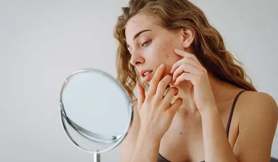 Ove namirnice uzrokuju akne i kod odraslih osoba