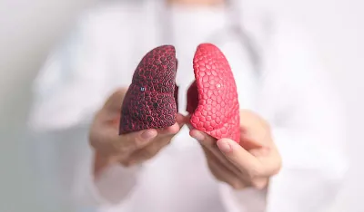 Za&scaron;to sve vi&scaron;e nepu&scaron;ača obolijeva od raka pluća: Naučnici sada imaju odgovor