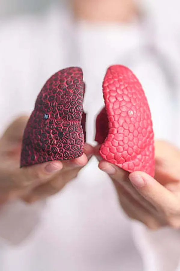 Za&scaron;to sve vi&scaron;e nepu&scaron;ača obolijeva od raka pluća: Naučnici sada imaju odgovor