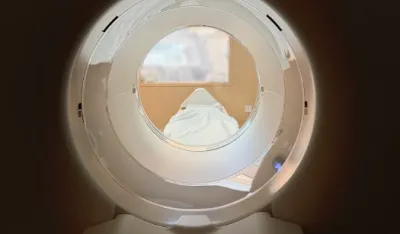 Njujork: Magnetna rezonanca usisala čovjeka, preminuo od zadobijenih povreda