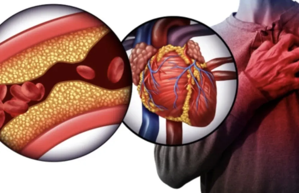 Nutricionisti otkrivaju: Ovo je pet zabluda o holesterolu