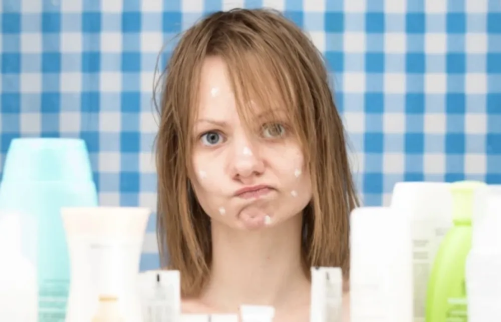 Da li masna hrana stvarno izaziva akne?&nbsp;