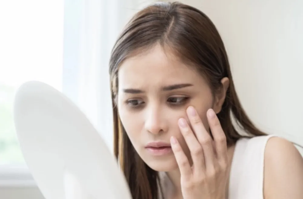 Promjene na koži koje mogu ukazivati na povi&scaron;en holesterol