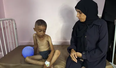 (FOTO) Nove žrtve gladi u Gazi, ukupno 422 od početka krize