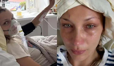 Bela Hadid izazvala zabrinutost objavom fotografija iz bolničkog kreveta: Žao mi je &scaron;to često nestajem