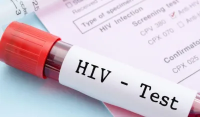 Istraživanja: Svaka četvrta osoba koja ima HIV ima simptome umjerene ili te&scaron;ke depresije
