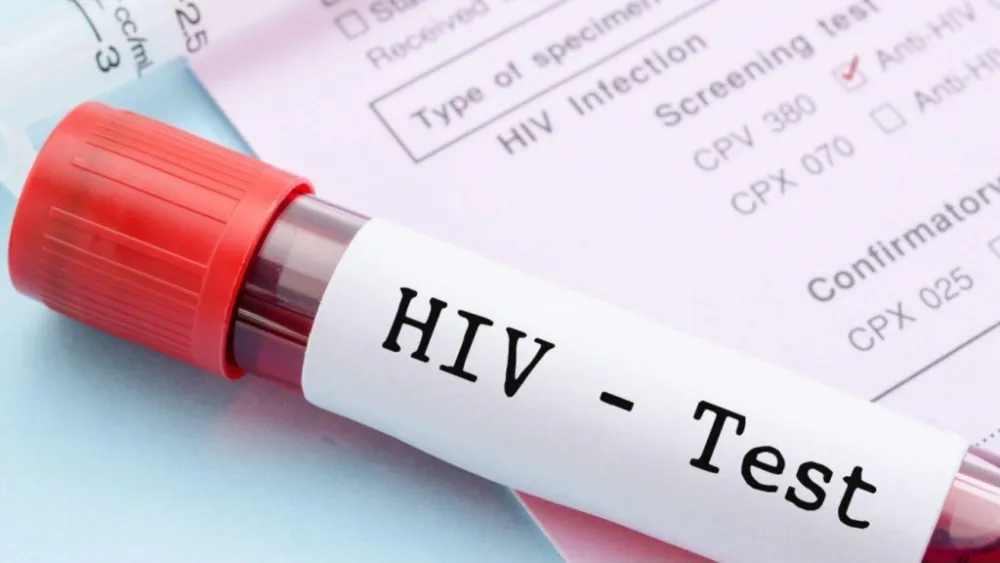 Istraživanja: Svaka četvrta osoba koja ima HIV ima simptome umjerene ili te&scaron;ke depresije