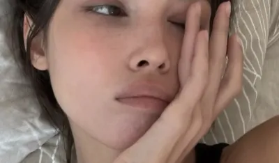 Otečeni kapci ujutro: Brzi trikovi za osvježen izgled očiju