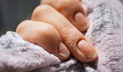 Evo kako prepoznati da va&scaron;em tijelu nedostaje proteina