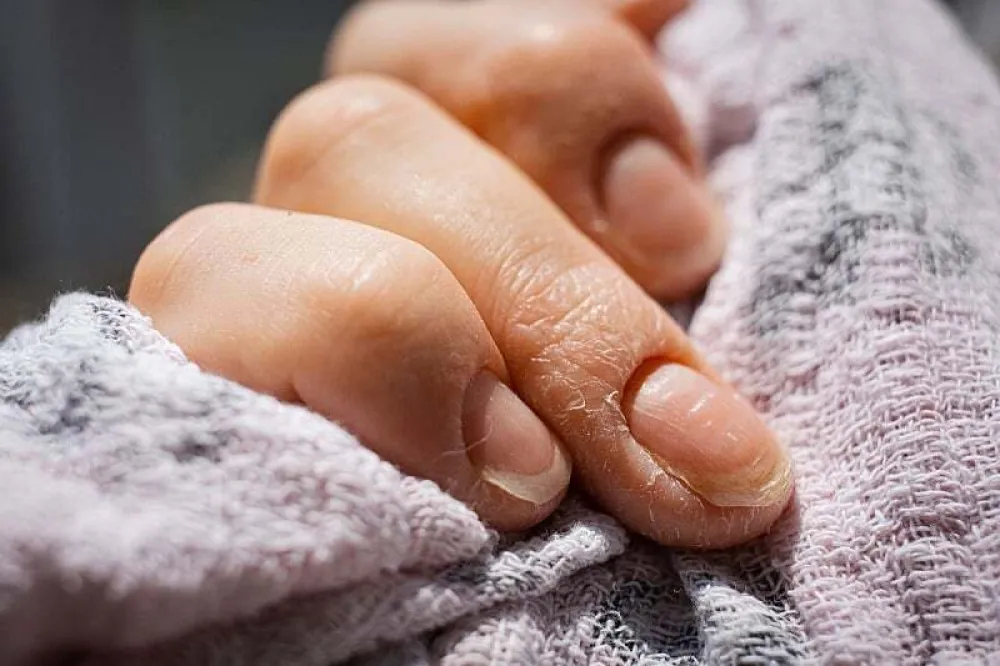 Evo kako prepoznati da va&scaron;em tijelu nedostaje proteina