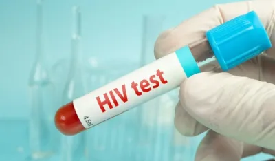 Njemački naučnici prona&scaron;li antitijelo protiv HIV-a