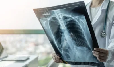 Novi test krvi otkriva &scaron;irok spektar karcinoma u ranoj fazi