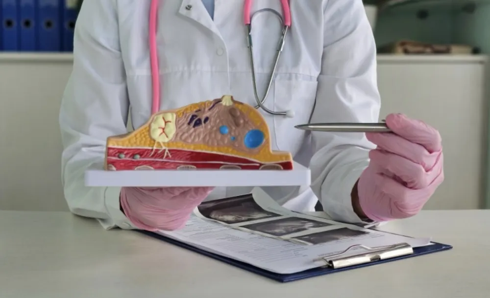 Revolucija u zdravstvu: Vje&scaron;tačka inteligencija pomaže u dijagnozi agresivnog kancera dojke?