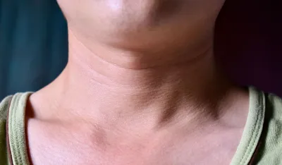 Kada je upala limfnih žlijezda znak za uzbunu?