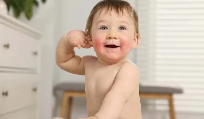 Kako prepoznati i ublažiti atopijski dermatitis kod beba