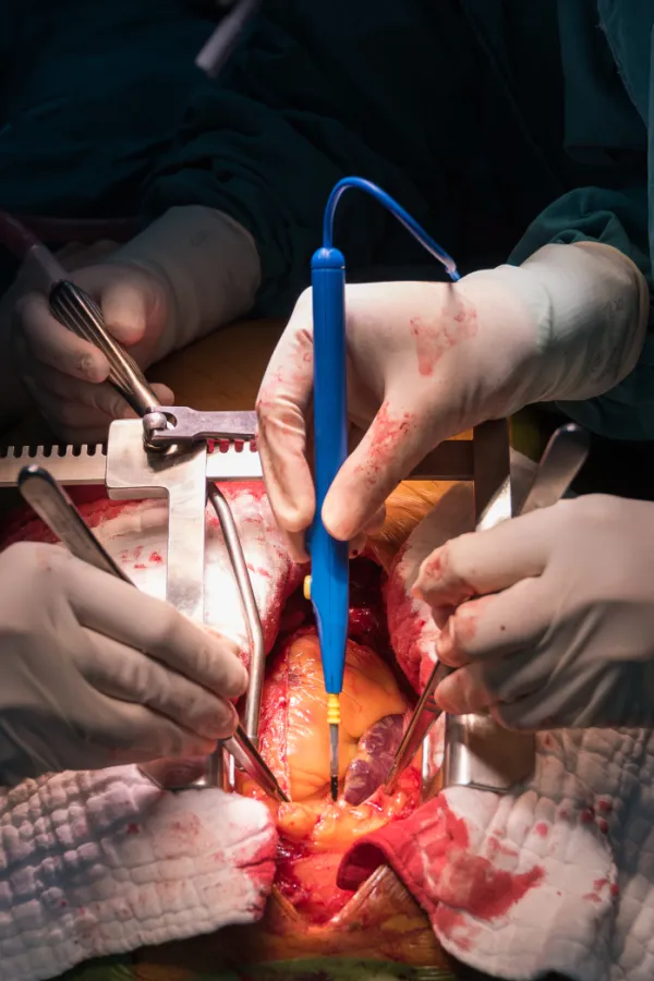 U Sjevernoj Makedoniji deset pacijenata nepotrebno operisano na srcu