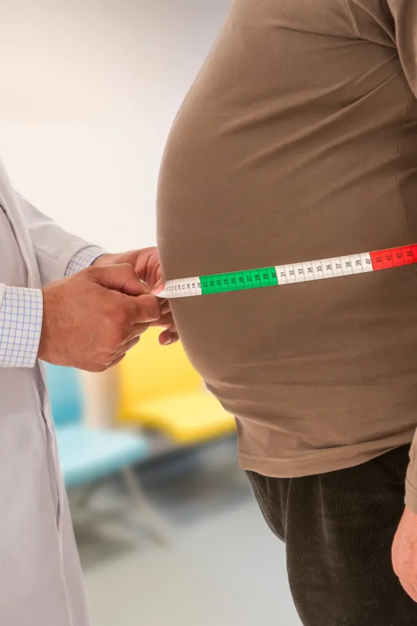 Svako četvrto dijete u Italiji ima prekomjernu težinu