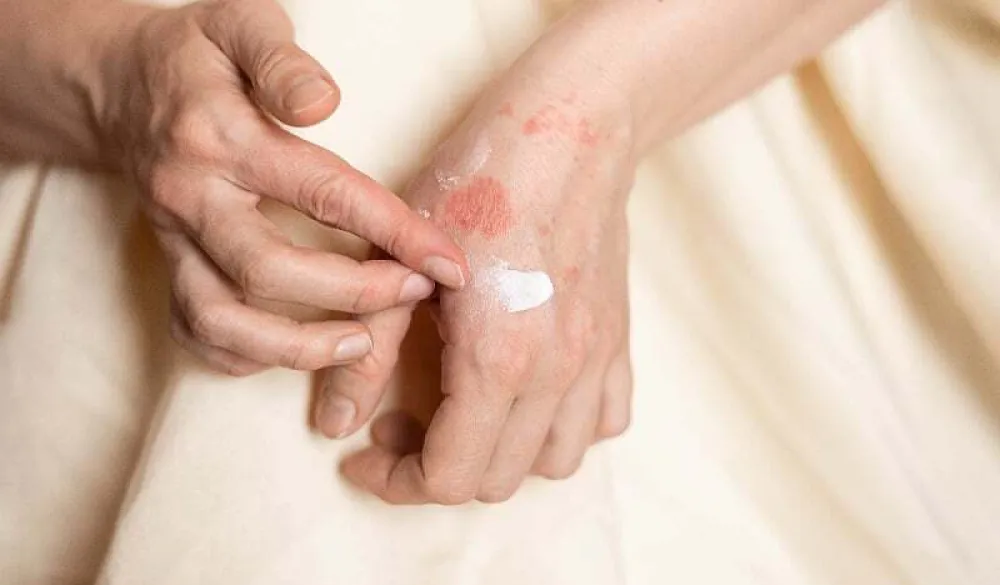 Ovo su rani znakovi nedostatka vitamina C koje ne biste trebali ignorisati