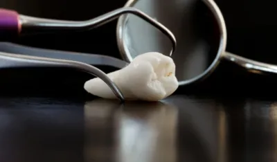 Da li umnjaci kriju ključ budućeg izlječenja?Od otpada do medicine koja spasava živote&nbsp;