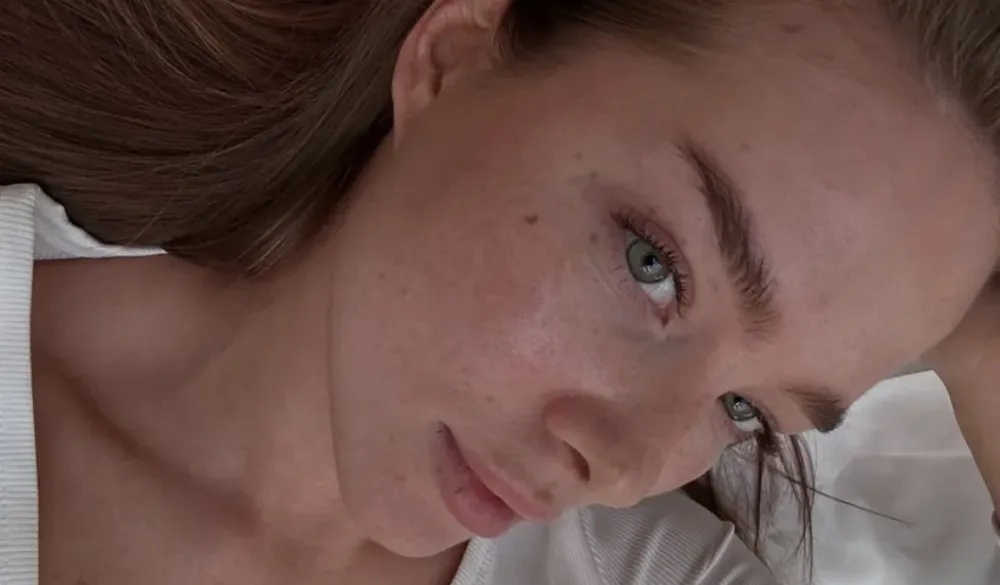 Zimska skincare pravila:&nbsp;Koje kiseline za lice izbjegavati?