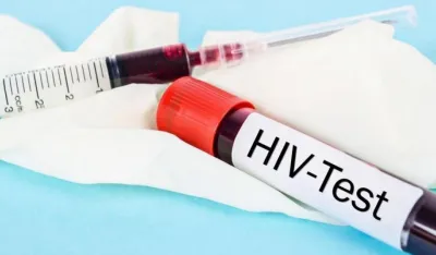 U Crnoj Gori 503 slučaja inficiranja HIV-om, preminula 72 pacijenta: Ove godine sida otkrivena kod 41 osobe