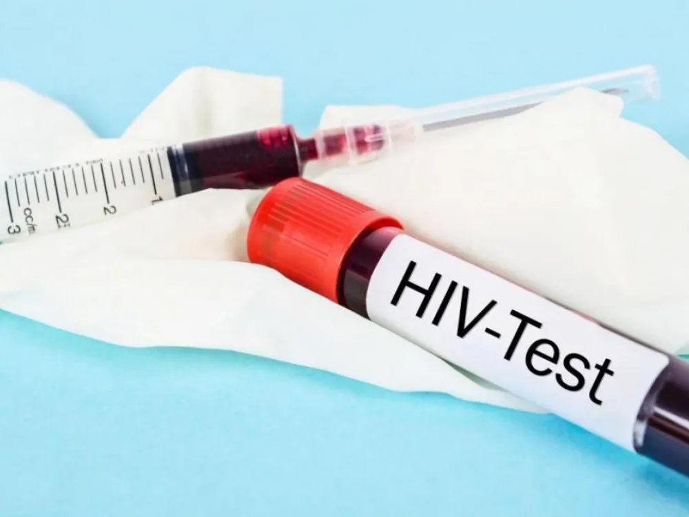 U Crnoj Gori 503 slučaja inficiranja HIV-om, preminula 72 pacijenta: Ove godine sida otkrivena kod 41 osobe