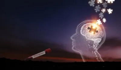 Novi dokazi o Alchajmerovoj bolesti: Otkriven uzročnik bolesti